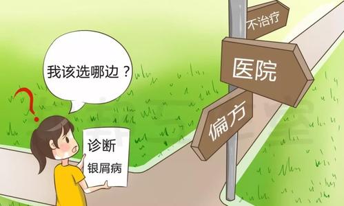 银屑病的治疗方法哪些好