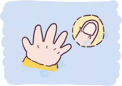 治疗牛皮癣你有从根源入手吗 治疗牛皮癣你有从根源入手吗