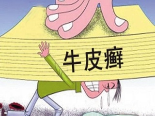 热点资讯:冬季牛皮癣饮食注意哪些 u=2813547559,2416356290&fm=26&gp=0.jpg
