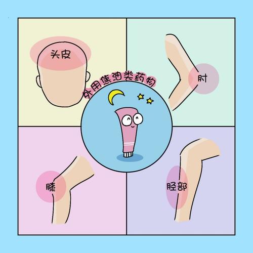 银屑病还会扩散吗